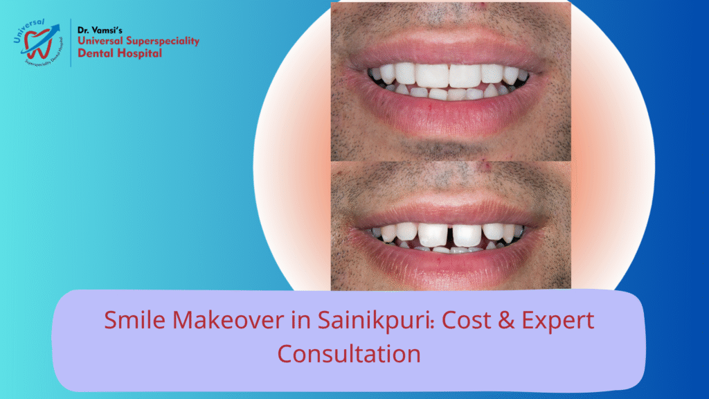 Smile Makeover in Sainikpuri