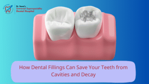 Dental Filling Treatment