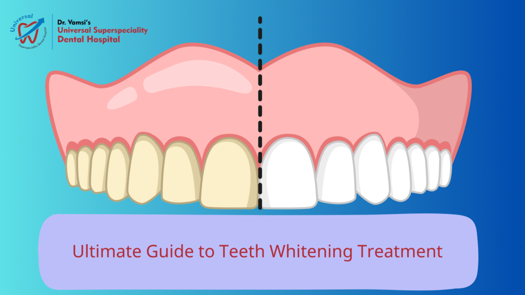 Ultimate Guide to Teeth Whitening Treatment