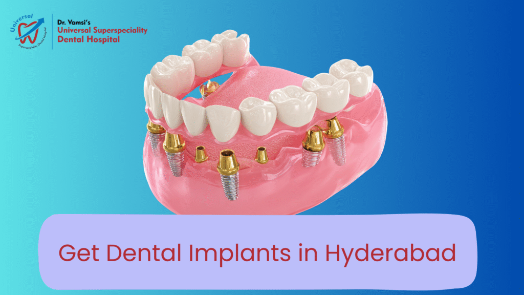 Dental Implants in hyderabad