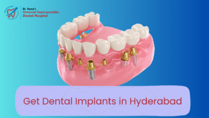 Dental Implants in hyderabad